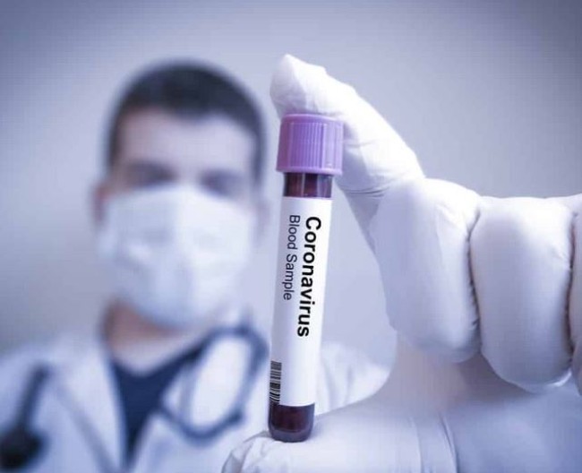 Coronavirus in Calabria. Nessun nuovo positivo. In provincia di Cosenza sotto i 100 contagiati
